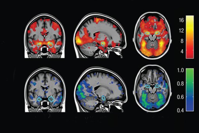 Función Mental en el SUP: Lo invisible que se hace visible por Gabriel Herskovits